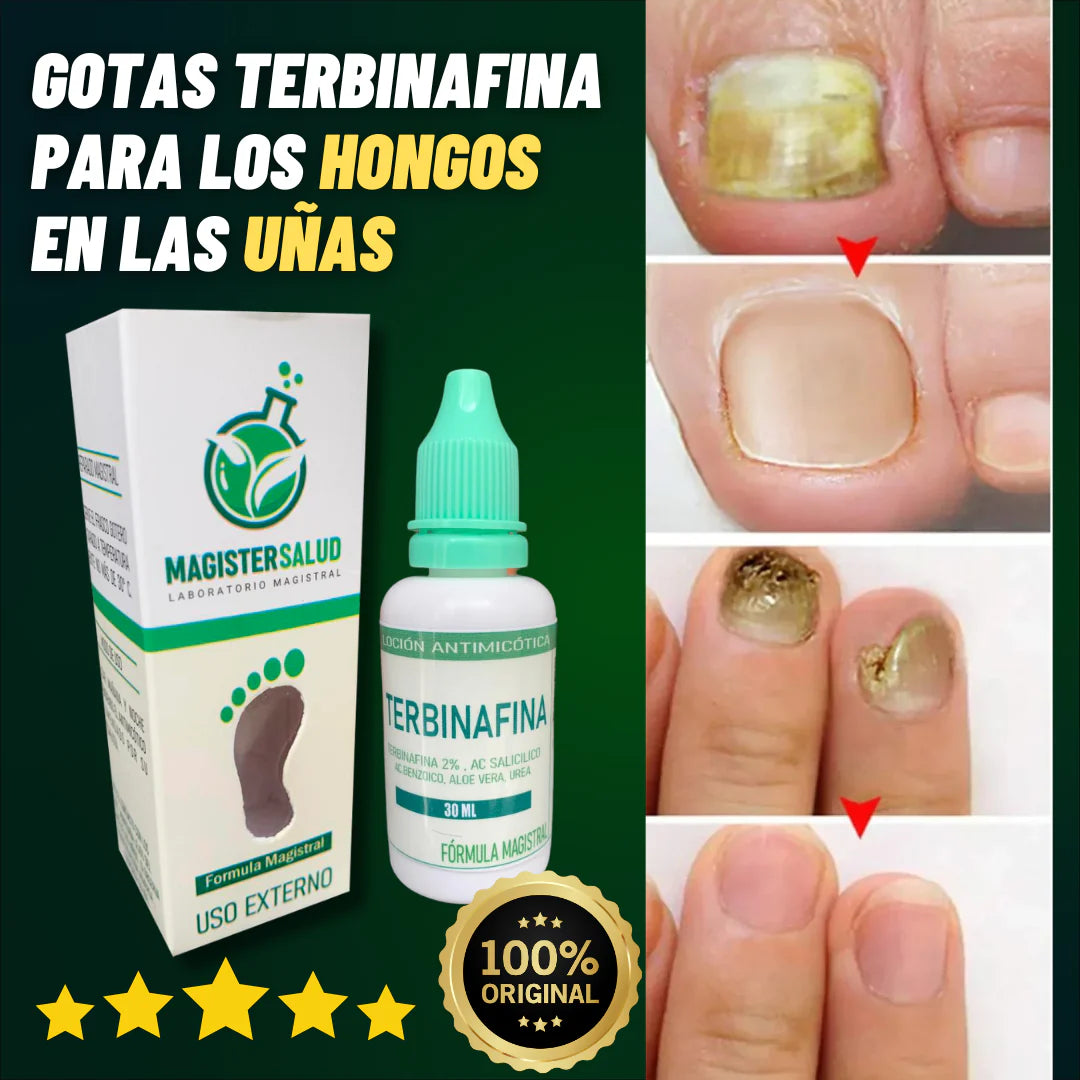 GOTAS DE TERBINAFINA PARA LOS HONGOS EN LAS UÑAS